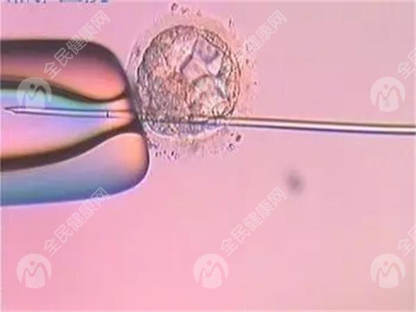 试管配成胚胎的成功率是多少？试管配成胚胎少的原因有哪些？