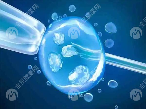 卵巢早衰选试管婴儿超短方案的流程怎么样？主要有哪些步骤？