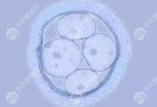 不完全纵隔子宫胚胎移植多少钱