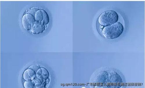 广东试管婴儿费用能否通过医保报销?