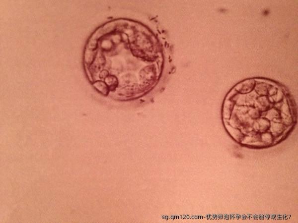 优势卵泡怀孕会不会胎停或生化？